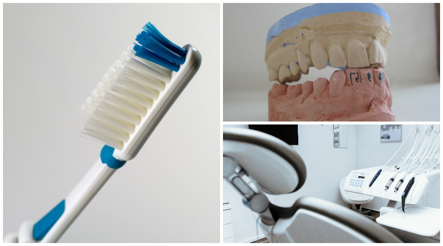 Complicaciones con implantes dentales