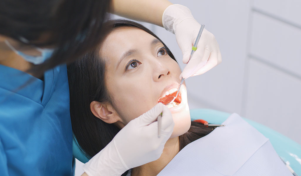 desgaste-dental-dentista